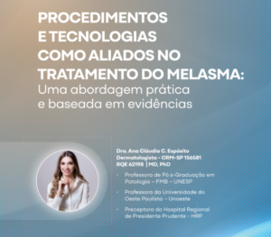 Procedimentos e tecnologias como aliados no tratamento do melasma – Dra. Ana Cláudia C. Espósito