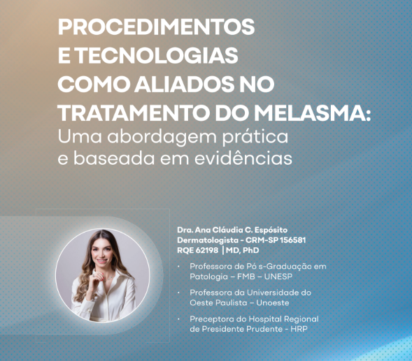 Procedimentos e tecnologias como aliados no tratamento do melasma – Dra. Ana Cláudia C. Espósito